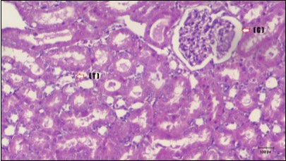  Photomicrogragh of kidney section of treated rat with Fenugreek showing improvement of Bowman,s capsules with normal glomerular (arrow) and nearly return of distal tubules (dashed –arrow) and proximal tubules (star) (H&E) (40xX).