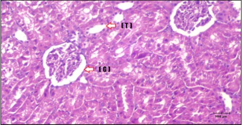  Photomicrogragh of kidney section of treated rat with Glimepiride showing improvement of Bowman,s capsules and partial improvement of glomerulir (arrow) and completely return of distal tubules and proximal tubules to the normal shape  with wide urinary space. (H&E) (40X).