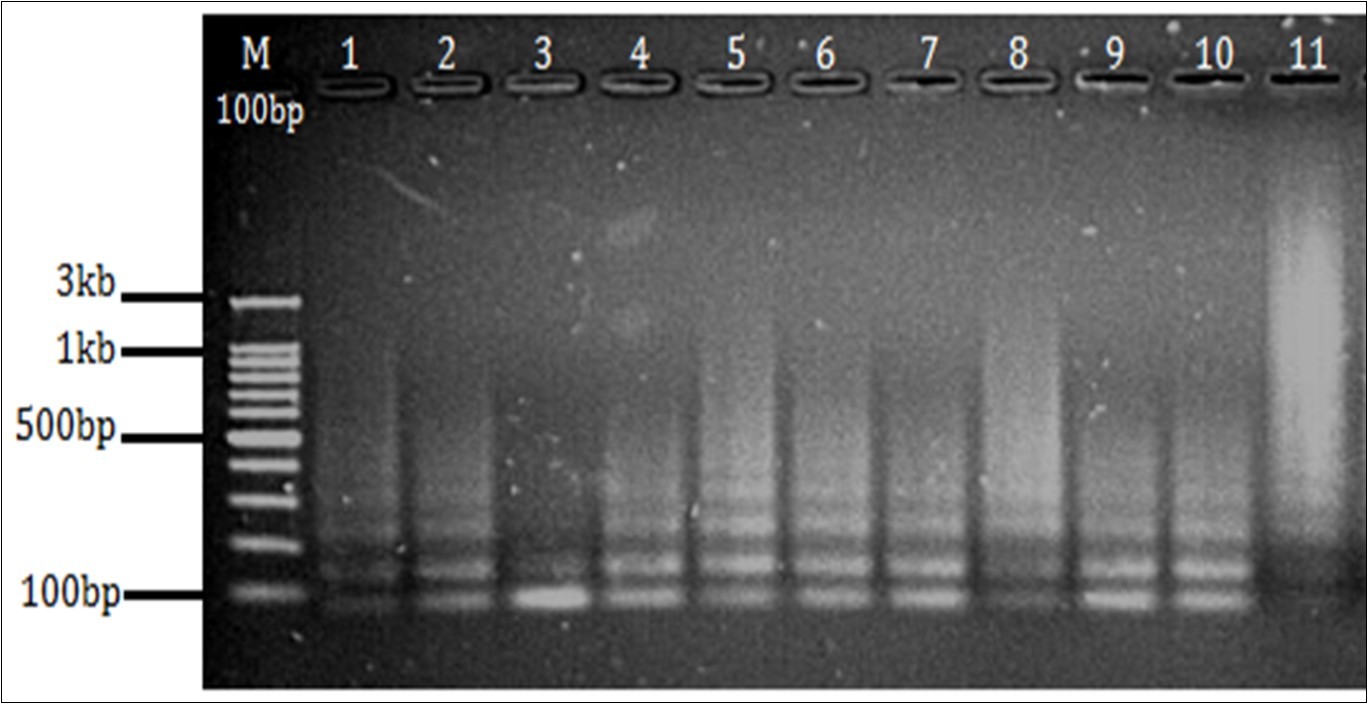  Agarose gel electrophoresis 1.5% gel showing amplification of DR region.   (M- 100 bp marker Well no.             1-9 PCR products from sample no. 1 to 9, well no 10- Positive control(M. tuberculosis H37Rv), 11- Negative                  control.