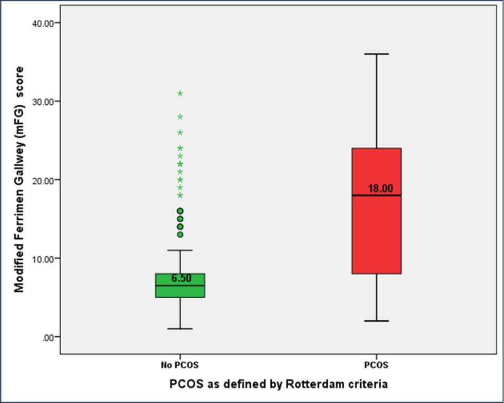  Differences in hirsutism as defined by modified FG score between subjects defined to have PCOS or otherwise as per Rotterdam defined criteria ((PCOS=169, Mean=17.33 + 9.05) (No PCOS=164, Mean=8.21 + 5.74), p< 0.001)