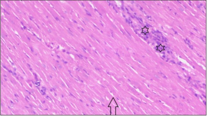  Photomicrograph of heart section of treated rat with fennel  herb showing improved cardiac tissue with less infiltration (star) and well organized elongated muscle fibers with peripheral nuclei (arrow), (H&E) (400X).