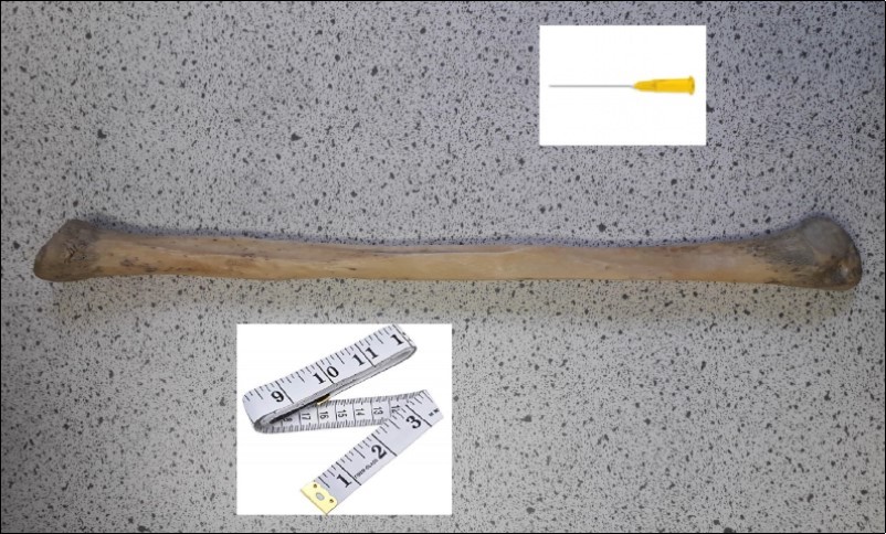  A fibula specimen and materials used in methods