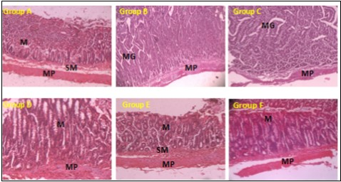  Photomicrographs of the colon. Group A (Control), Group B (DMH Only), Group C (DMH + OG20), Group D (DMH + OG40), Group E (DMH + OG80), Group F (DMH + Celecoxib). (H & E 100x). M – Mucosa, SM – Submucosa, MP – Muscularis propria, MG – Malignant glands 