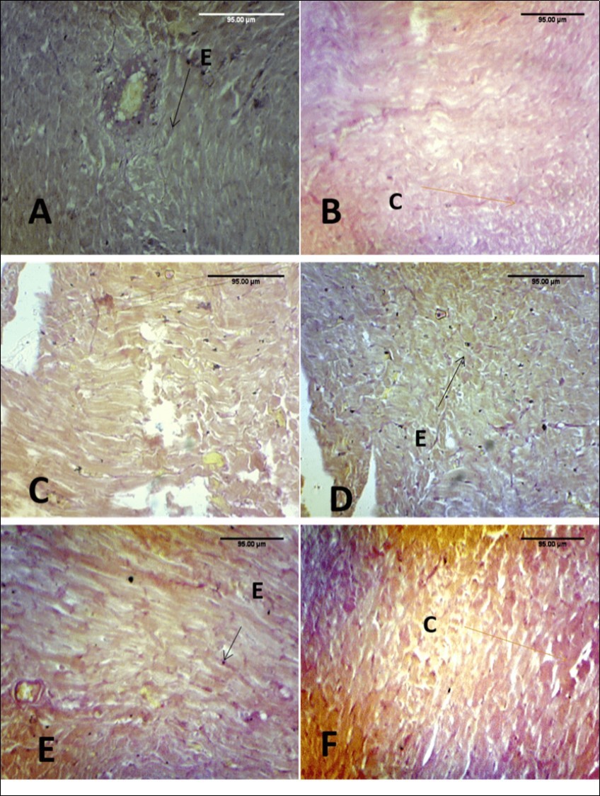  Effect of paraquat exposure on the elastic and collagen fibre distribution of the rat heart (A) Control, (B) Paraquat only, (C) MEAS 100mgkg-1, (D) MEAS 200mgkg-1, (E) Vitamin E 100mgkg-1, (F) Recovery group. VVG (x100) 
