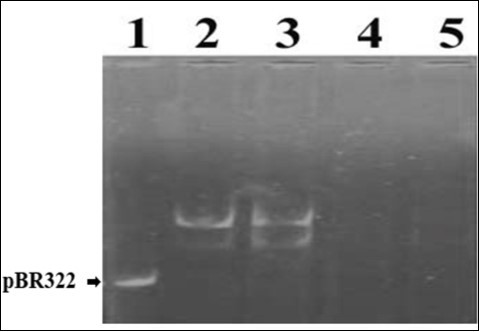  Standardization of plasmid pBR322            concentration and DNA damage by Fenton’s                 Reagent. Lanes 1-5 contained 15ng of DNA and 0, 1, 2, 3 and 4µl of FR, respectively.