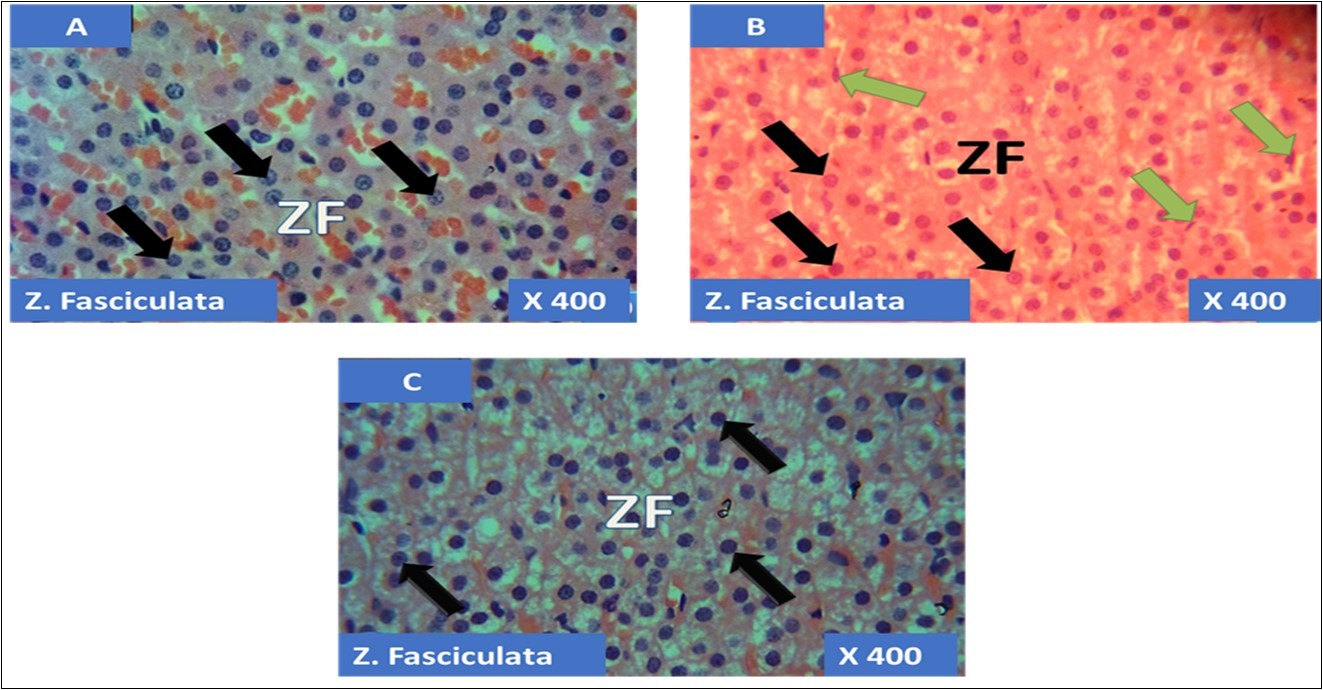  showing the cellular layer of Zona Fasiculata of Adrenal gland group A (control), group B (T1) and group C (T2). The evenly distributed normal large polydhedral cells having long, straight cords, swollen with lipid droplets in A (black arrows), evenly distributed normal polydhedral cells (black                   arrows) with few obliterated cells(green arrows) in B and in C, the black arrows pointing to  the evenly                distributed normal polydhedral cells (black arrows). H&E x400 