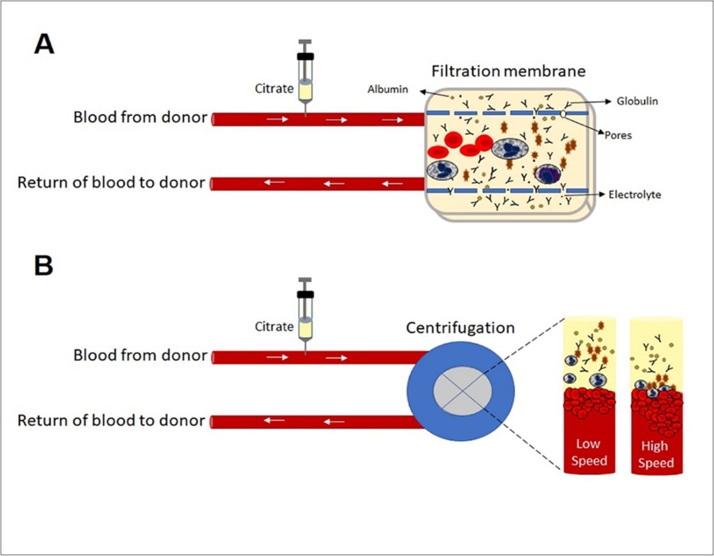  Centrifugation and filtration principle in collecting immune            plasma component with apheresis device.