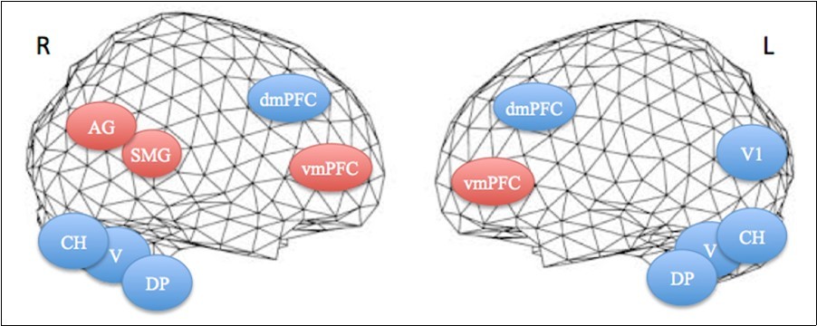  Projections of activated areas on a brain mesh showing networks involved in the first apnea (blue labels) and second apnea (red labels). Dorsomedial (dmPFC) and ventromedial       prefrontal cortices (vmPFC), dorsal pons (DP), vermis (V) and cerebellar hemispheres (CH) are activated bilaterally, while inferior parietal cortex, including the angular gyrus (AG) and the            supramarginal gyrus (SMG), is on the right hemisphere and medial visual cortex (V1) on the left one. R=right. L=left.