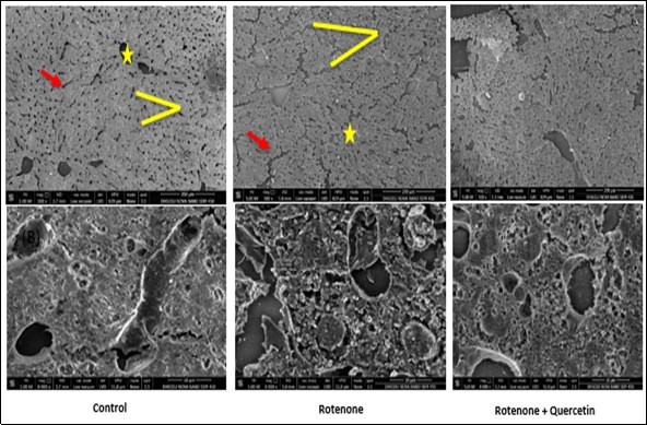  Scanning electron micrographs of liver of rotenone and co- administration of             quercetin mice . Control group showing  normal appearance of  hepatocytes strands ( red arrow), central vein (yellow star); surrounding the normal sinusoids (yellow line ), Rotenone administrated group,  shows loss of hepatic strands (red arrows);  abnormality in sinusoids (Yellow line). Rotenone + quercetin treated group showing classical hepatic strands ,normal structure of blood sinusoids , central vein  and normal appearance  of hepatocytes .Scale Bar 200 μm  and 10 μm.