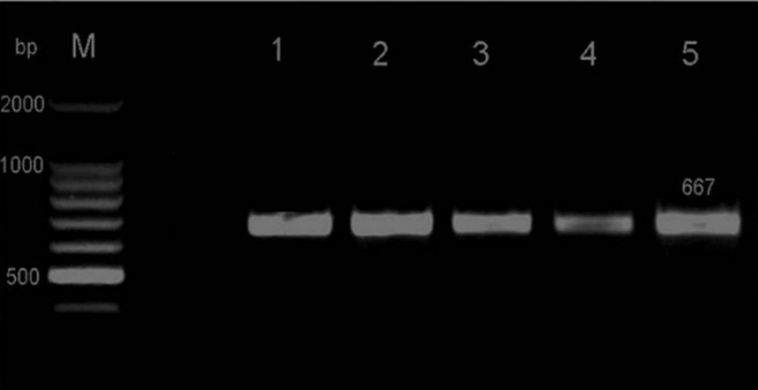  Agarose gel of HSP70h PCR products. M Marker (100 bp ladder), lane 0 negative control, lane 1 positive control, lane 2 KP243751, lane 3 KP243759, lane 4 KP243752, lane 5 KP243754. Bands correspond to amplicons having a size of 667 bp.