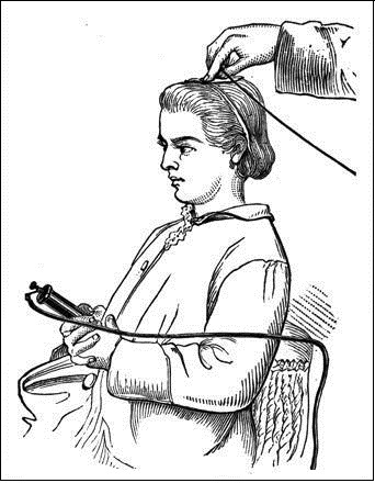  Electrotherapy. A person receives electrical shocks from a portable electrical device. FromGM, Rockwell AD.A practical treatise on the medical and surgical uses of electricity, 6th ed. New York, NY: Wm Wood & Co., 1888