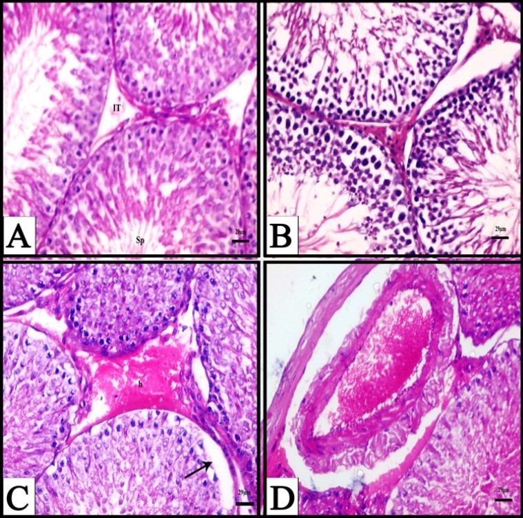  A) A photomicrograph obtained from testis of a control rat showing normal seminiferous tubules, different stages of spermatogenic cells, spermatozoa (Sp) and interstitial tissue (IT), (H&E). B) A photomicrograph obtained from testis of a rat treated with fennel oil for six weeks showing normal structure of seminiferous tubules, (H&E). C) A Photomicrograph obtained from testis of a rat treated with CPA for three weeks showing interstitial haemorrhage (h), and separation of germ layers from underline basement membrane (arrow), (H&E). D) A Photomicrograph obtained from testis of a rat treated with CPA for three weeks showing congested and enlarged blood vessel, (H&E).