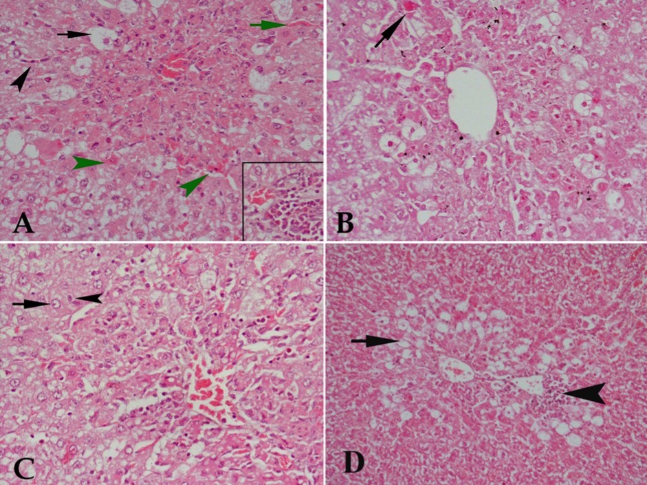  Hx & E stained liver tissue from (A) control rat receiving CCl4 showing severe degenerative changes in liver tissue in the form of marked vacuolar degeneration of many hepatocytes (black arrow), acidified hepatocytes (green arrowhead), congestion of blood sinusoids (green arrow) and  cellular infiltration either diffuse in the center of the lobule or in blood sinusoids (black arrowhead). The lower right part of the figure shows focal aggregation of cellular infiltrates.  (B)  CCl4 and 10 mg/kg buspirone showing no protective effect against the damaging effect of CCl4 as acidified cells (arrow), vacuolar degeneration of most hepatocytes and cellular infiltration are still observed. (C) CCl4 and 20 mg/kg buspirone showing minimal protection against the damaging effect of CCl4 as some cells appear with normal nuclei (arrow) and others are with pyknotic nuclei (arrowhead), although many cells show vacuolar degeneration, cellular infiltration in the center of the lobule is still present and architecture of liver tissue is markedly deformed. (D)  CCl4 and 30 mg/kg buspirone showing mild protection of the drug against the damaging effect of CCl4 . Cellular infiltration is localized at focal areas beside central vein (arrowhead) with restriction of vacuolar degeneration to the area around central vein (arrow).