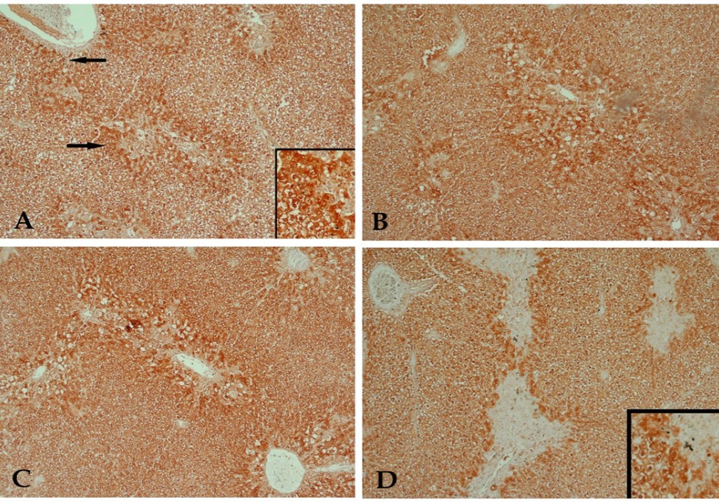  A photomicrograph of a section of liver tissue stained with anti-caspase-3 antibody with streptavidin-biotin from (A) control rat receiving CCl4 showing many hepatocytes with positive          immune- reaction to the stain (arrow).  (B)  CCl4 and 10 mg/kg buspirone showing a result close to that of the previous group. (C) CCl4 and 20 mg/kg buspirone showing minimal reduction of the       positively stained cells.  (D) CCl4 and 30 mg/kg buspirone showing mild reduction of the positively stained cells