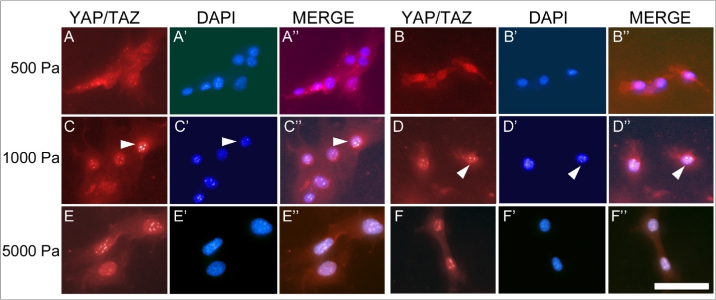  (A-F) Immunohistochemistry for the YAP/TAZ complex in Müller cells at 16 days in culture. The YAP/TAZ complex is localized to the cytoplasm of cells grown on 500 Pa (A, B) and 1000 Pa (C, D) gels, as demonstrated by the corresponding DAPI staining of DNA (A’, B’, C’, D’). The YAP/TAZ complex in cells grown on 5000 Pa gels (E, F) is localized to the nucleus, as shown by DAPI stain (E’, F’). Scale bar: 50 microns.