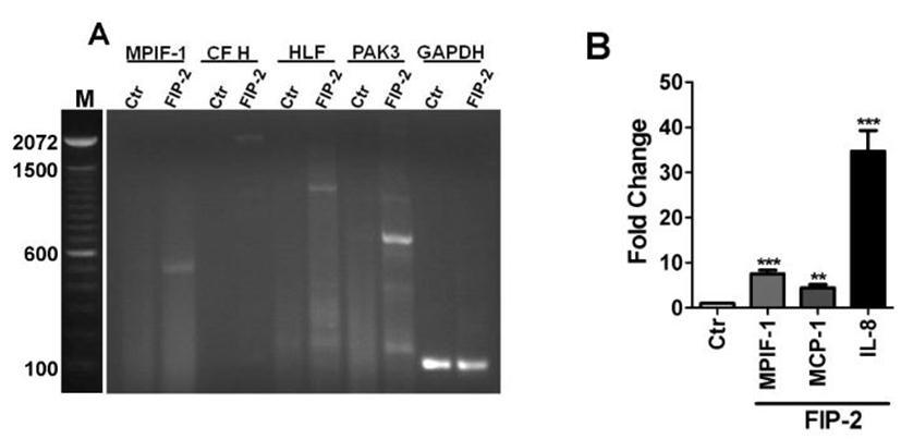  Validation of gene expression. Total RNA from the mock (Ctr) and FIP-2 transfected cells was tested by RT-PCR (A) and Q – RT-PCR (B) using specific primers as described in Materials and Methods. GAPDH was used as a control housekeeping gene. M – Markers (100bp DNA Ladder from Life Technologies/Invitrogen). MPIF-1 - Myeloid progenitor inhibitory factor 1, CF H – Complement Factor H, HLF – Hepatic Leukemia Factor, PAK3 - p21 protein (Cdc42/Rac)-activated kinase 3, GAPDH - Glyceraldehyde 3-phosphate dehydrogenase, MCP-1 - monocyte chemotactic protein-1, IL-8 – Interleukin-8 (CXCL8, chemokine (C-X-C motif) ligand 8).    