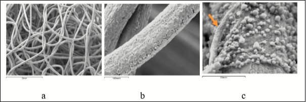  A mesh design made of titanium nickelide implanted into the defect of the metaphysis of the         femur: a - general view of the implant, b - microrelief of the surface layer of the implant filament,                       c - adhesion of malodifferentiated cells and newly formed capillary terminals (arrow) on the surface of the filament 7 days after the operation. Scanning electron microscopy, magnification:                                        a - × 13, b - × 190, c - × 475.