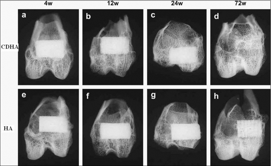  Soft X-ray photographs of the operated portion of the rabbit femur. Four weeks (a), 12 weeks (b), 24 weeks (c) and 72 weeks (d) after implantation of CDHA; 4 weeks (e), 12 weeks (f), 24 weeks (g) and 72 weeks (h) after implantation of sintered HA. Reprinted from Ref. 133 with permission.