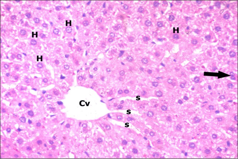  A photomicrograph of a section in the liver of a control adult albino rat showing polygonal hepatocytes (H) radiating from central vein (Cv) with rounded vesicular nuclei and acidophilic cytoplasm. Narrow radiating blood sinusoids (s) in between liver cords and their lining endothelium are noticed. Binucleated cell is also seen (thick arrow). (H&E  X400) 