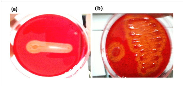  PJK 6 showing zone of hydrolysis on (a) CMC agar (b) Wheat bran agar