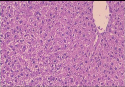  Photomicrograph of liver section of treated rat both with both fennel herb and Ator drug showing nearly normal hepatocytes  (H&E) (40X).