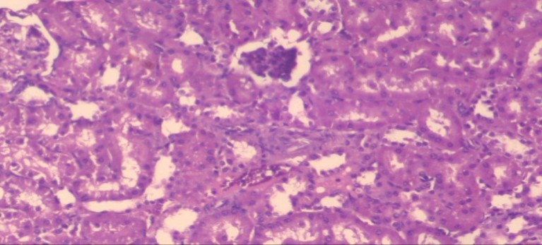  Photomicrogragh of kidney section of treated rat with Ator drug showing improvement in                                  Bowman's capsules with normal  glomerular and partial                     improvement in proximal tubules  and distal tubules,  (H&E) (40X).