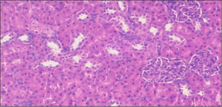  Photomicrograph of kidney section of treated rat with both fennel herb and Ator drug showing highly improved tissue with normal glomerular. Note, most Bowman's capsules and renal tubules, restoring their normal appearance (star).  (H&E) (40X).
