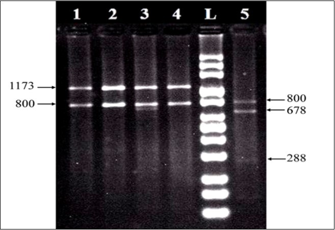  RFLP profiles of 18S nrDNAs digested with Taq I. Clade C profiles (lanes 1-4) was identified from Acropora digitifera , Acropora humilis, Acropora pharaonis, and Stylophora pistillata, while clade A (lane 5) had been identified from Pocillopora verrucosa.