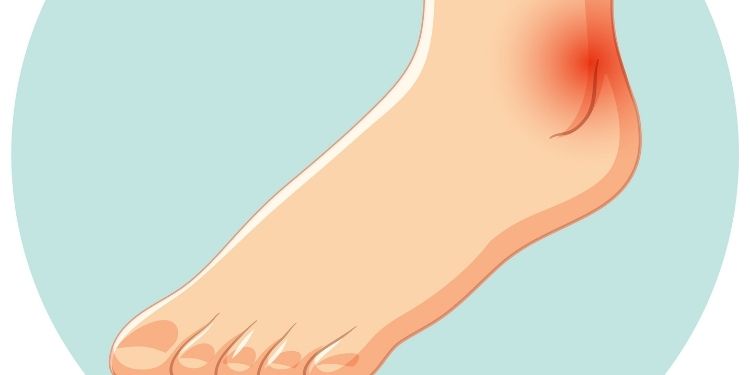 Journal of Tissue Repair and Regeneration - Diabetic Foot Ulcer