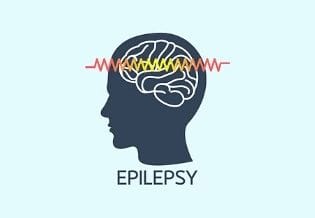 International Epilepsy Journal
